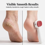✨🦶Double-Sided Foot Scraper – Easily Removes Calluses and Dead Skin